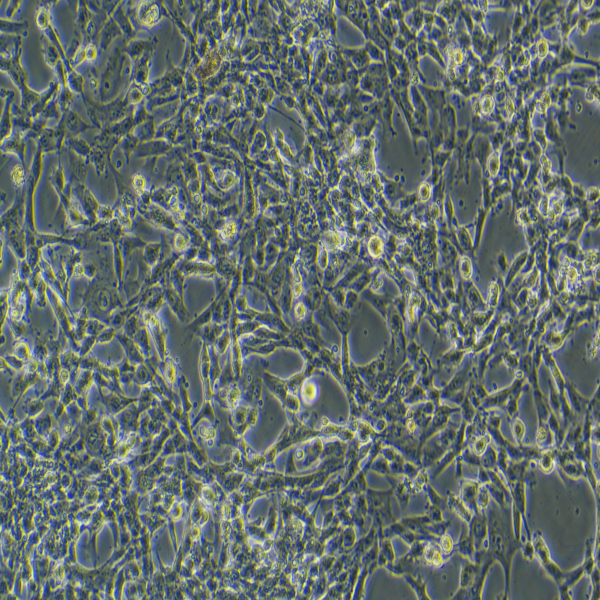 人肥大细胞激活和信号传导机制的深入研究