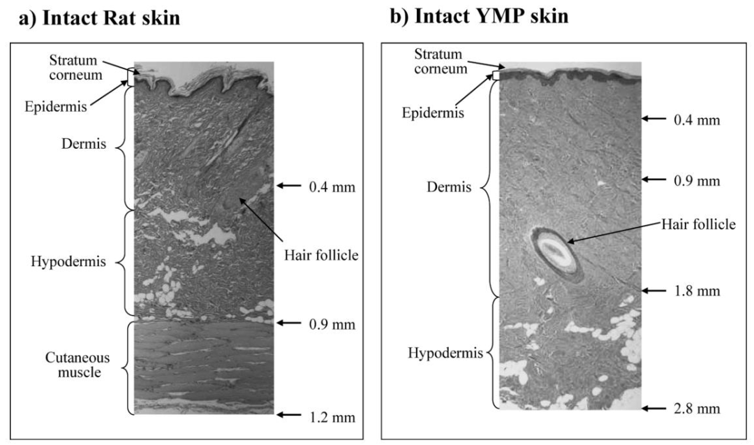 文献分享 | 离体皮肤厚度和经皮电阻测试值大小TEER的关系研究