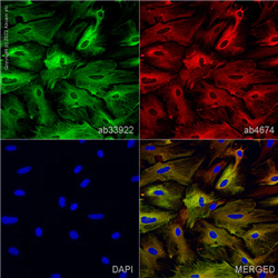 ab33922抗胶质纤维酸性蛋白 (GFAP) 抗体