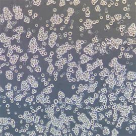 人霍奇金淋巴瘤細胞HDLM-2(STR鑒定正確)