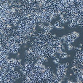 人食管鱗狀細胞癌KYSE-450(STR鑒定正確)