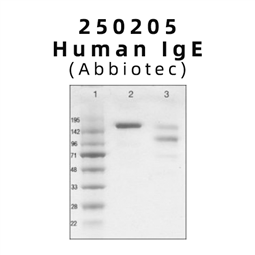 Human IgE（免疫球蛋白E）