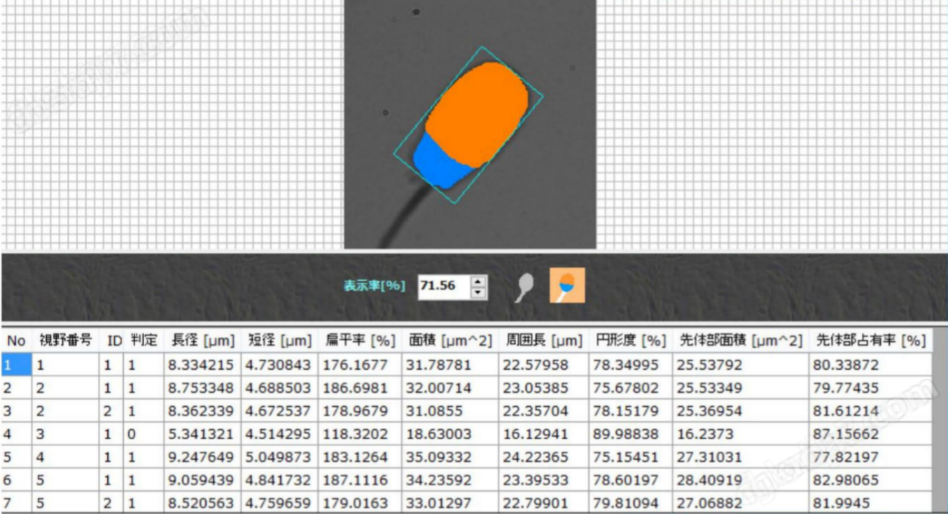 精子活力/形態(tài)分析系統(tǒng)