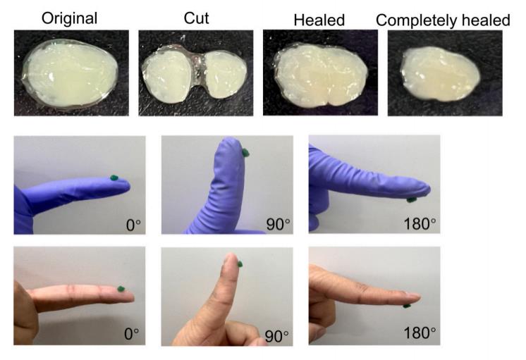 IF12.5 一区:抗菌+促血管生成:壳聚糖水凝胶为糖尿病足治疗注入新希望