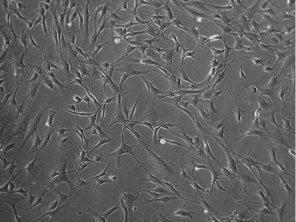 image.png LONZA原代人主动脉平滑肌细胞HAoSMC/HASMC 产品介绍