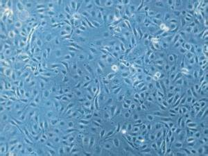 LONZA原代人冠狀動脈內(nèi)皮細(xì)胞HCAEC和培養(yǎng)基 產(chǎn)品介紹