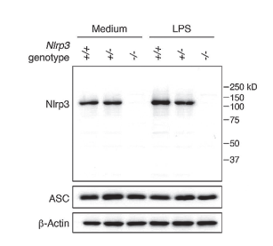 炎症小体研究：从固有免疫到适应性免疫-AdipoGen生命科学公司