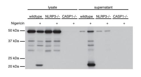 炎症小体研究：从固有免疫到适应性免疫-AdipoGen生命科学公司