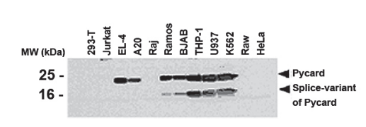 炎症小体研究：从固有免疫到适应性免疫-AdipoGen生命科学公司