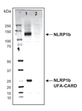 炎症小体研究：从固有免疫到适应性免疫-AdipoGen生命科学公司
