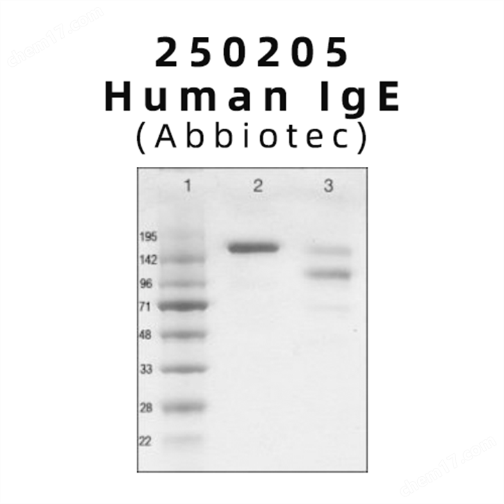 Human IgE（免疫球蛋白E）